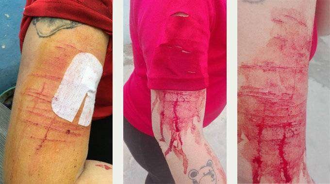 Fotografías de las heridas sufridas por la vicepresidenta de la Protectora de Animales