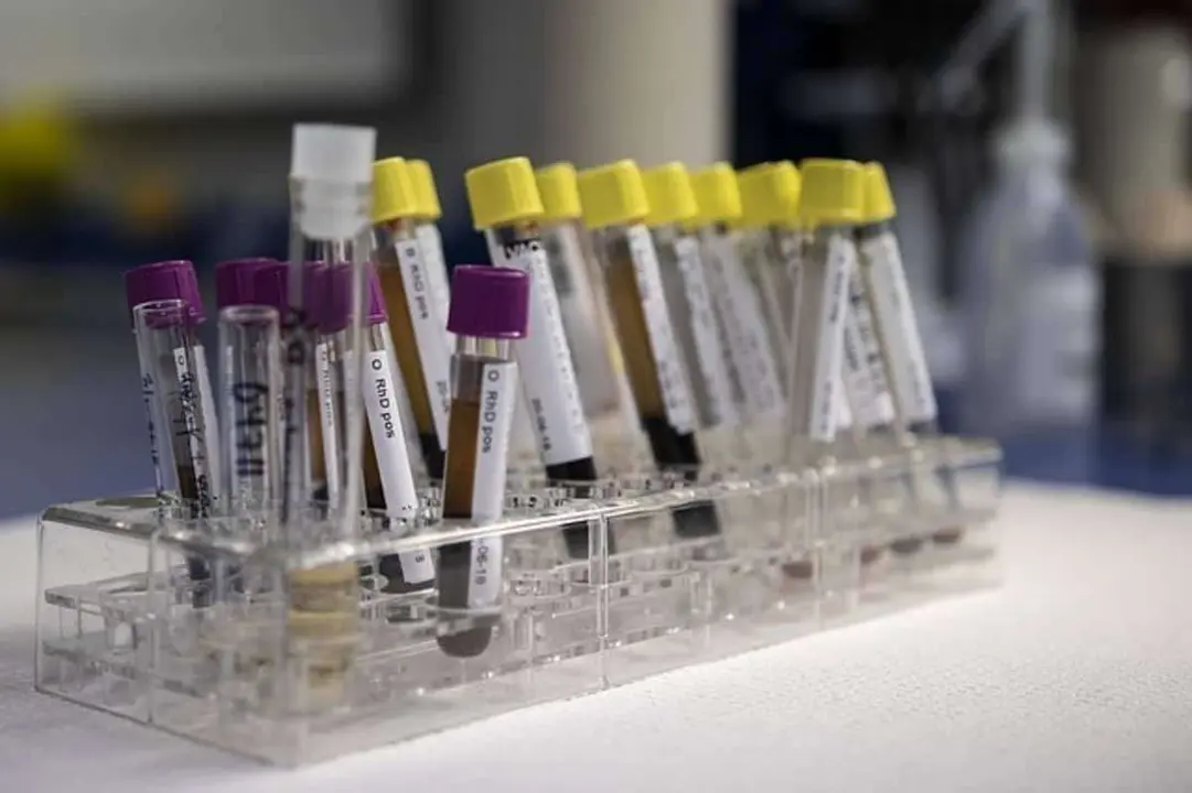 El coronavirus ataca m&aacute;s a este grupo sangu&iacute;neo