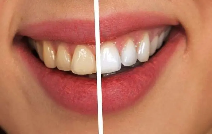 a3afb6e4-6aa1-4088-8fac-5e58753ba976_16-9-aspect-ratio_default_0