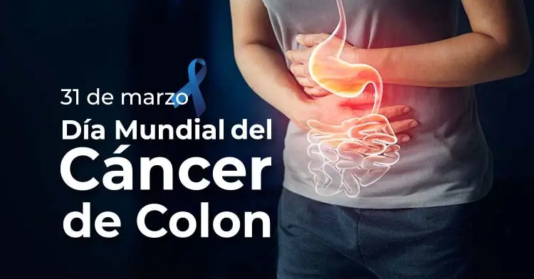 C&Aacute;NCER COLON