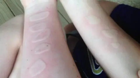 viral hielo y sal