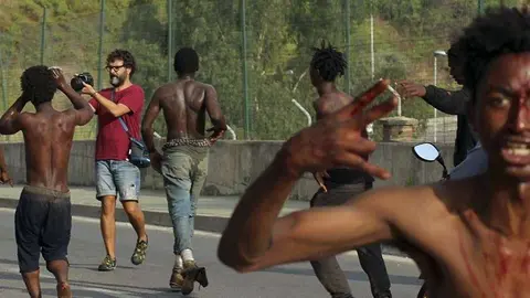 El joven Ibrahim muestra sus heridas minutos despu&eacute;s de franquear la valla (C.A./ARCHIVO)