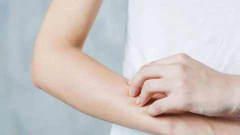  &iquest;Dermatitis at&oacute;pica en verano?: As&iacute; es c&oacute;mo puedes tratarla en casa. Foto freepik. 