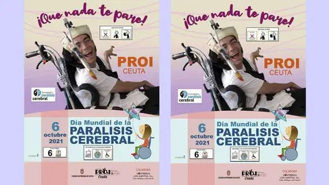 proi