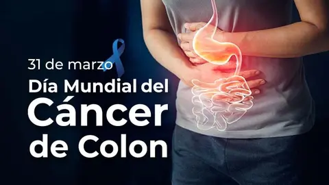 C&Aacute;NCER COLON